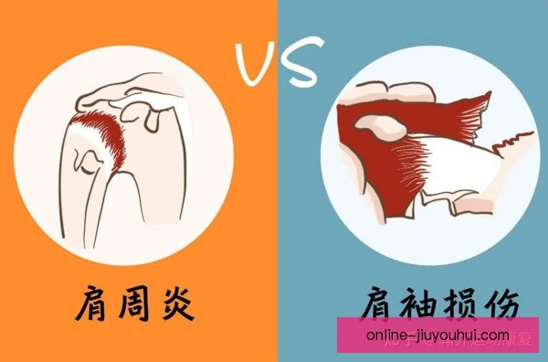 雪车肩袖损伤高发，防护与康复训练需并重